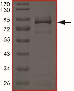 EGFR (d746-750 T790M) Protein
